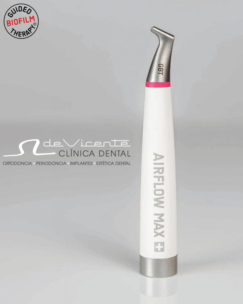 Limpieza de Dientes GBT en Granada en Clínica De Vicente Dental