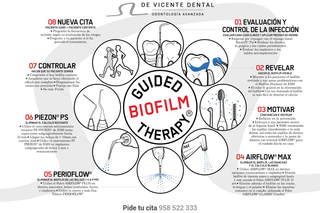 Limpieza de Dientes GBT en Granada en Clínica De Vicente Dental