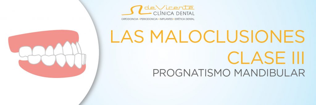Ortodoncia en Granada en clínica dental especializada en Ortodoncia desde hace 30 años De Vicente Dental