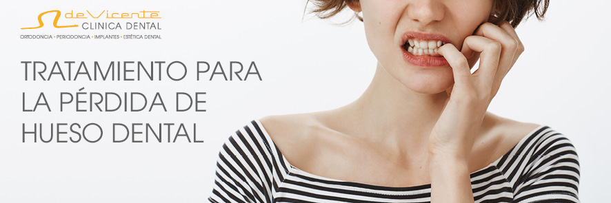 Implantes dentales en Granada en Clínica De Vicente Dental