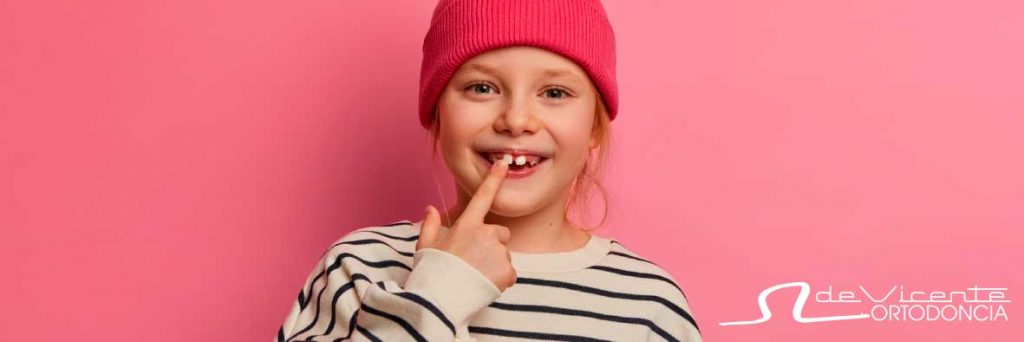 niña sonriendo para mostrar los dientes antes de tratamiento de ortodoncia infantil