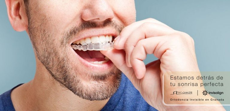 Ortodoncia invisible en clinica de vicente ortodoncia granada