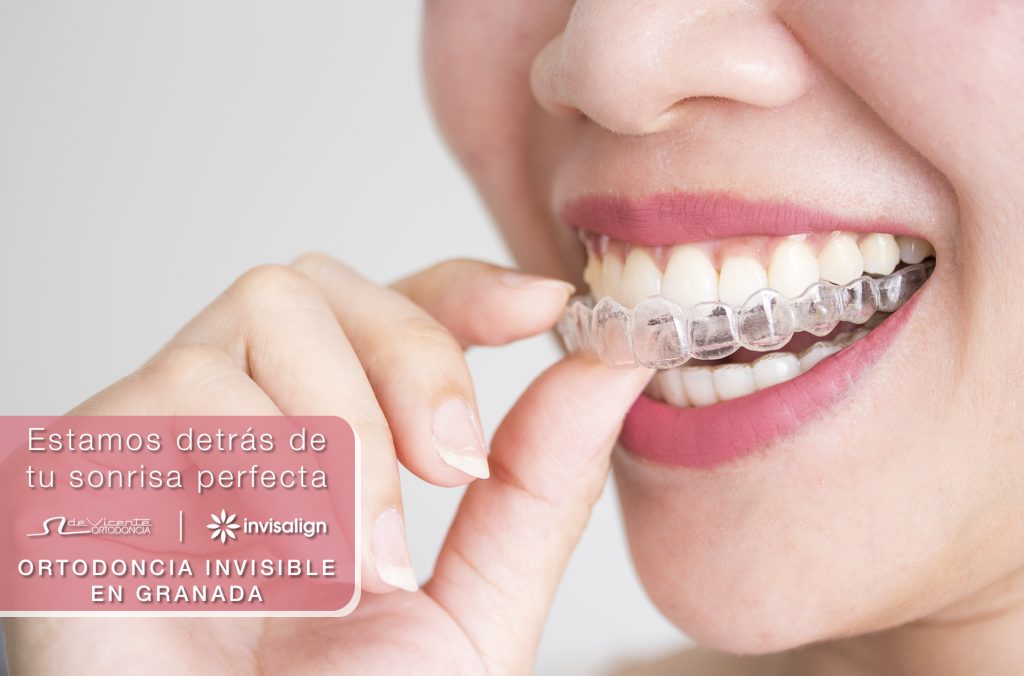 ortodoncia transparente invisalign en de vicente ortodoncia